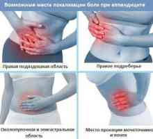 Simptomele caracteristice de apendicita la adulti