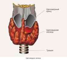 Scintigrafia tiroidiană
