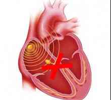 Bloc cardiac:, diverse locații complete și parțiale - cauze, simptome, tratament