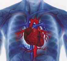 Bolile cardiovasculare - în special tratamentul și mortalității în Europa de Est