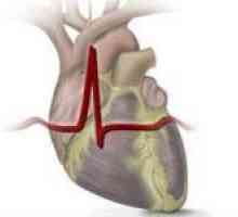 Cardiace reumatismale