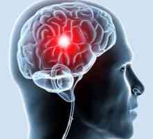 Șunt vaselor de sânge ale capului: acestea elimină încălcarea fluxului sanguin cerebral?