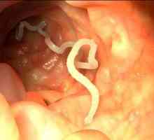 Simptomatologia și tratamentul de viermi