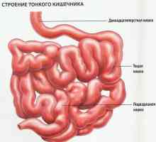 Boala de cancer de intestin subțire - semne și simptome