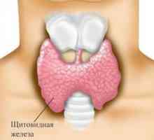 Simptomele de tiroidita autoimună sau limfomatoase
