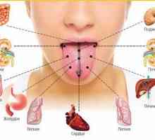 Simptomele bolii de sex feminin glandei tiroide: natura și simptomele bolilor