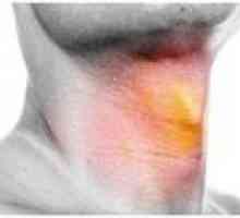 Simptomele și tratamentul hipertiroidie la bărbați