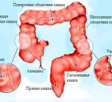 Simptomele si tratamentul cancerului colorectal