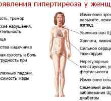 Simptomele și semnele de hipertiroidism la femei