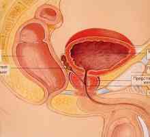 Simptomele de prostatita acută și cronică