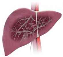 Sindromul Budd-Chiari, tromboza venelor hepatice și a fluxului sanguin hepatic