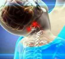 Sindromul arterei vertebrale