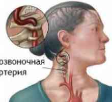 Sindromul vertebro-bazilară insuficiență