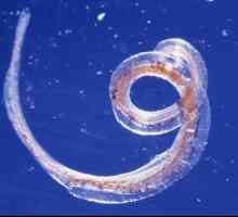 Sipptomy și tratamentul Whipworm uman