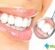 Cât de mult este de a albi dintii la dentist: tipurile și costurile de albire