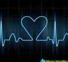 Slab inima - o ocazie pentru vizita la cardiolog