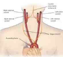 Boala artera carotida si sa