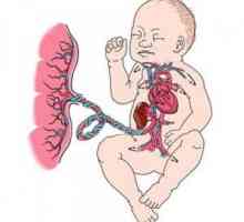 Vasele de cordonul ombilical și sindromul EAC: structura este normal, decât abateri periculoase pe…