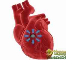 Sfaturi Medicina alternativa in tratamentul aritmiilor ventriculare