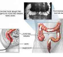 Aranjamentele pentru clisma intestinului bariu