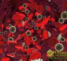 Gradul de anemie deficit de fier si modul de a trata aceasta boala remedii populare