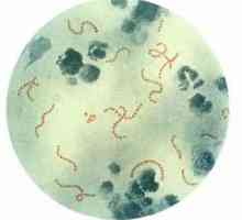 Streptococcus. Streptococcus detectată în nas, gât, faringe, piele, ce să fac? Streptococcus la…