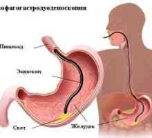 Pregătirea și efectuarea endoscopiei a stomacului