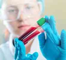 Trombocitele în testul de sânge redus - trombocitopenie: cauze si tratament
