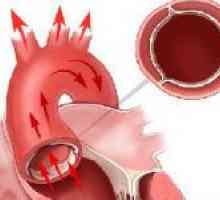 Etanșarea pereților aortei și valvei aortice