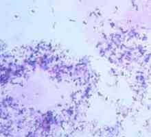 Ureaplasma urealitikum (Ureaplasma urealyticum): ce este și ce să facă în cazul în care o infecție…