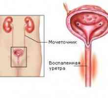 Uretrita la femei, un tratament popular. Simptomele bolii.