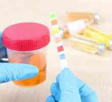 Analiza microalbuminurie: normele de colectare și de decodare a urinei