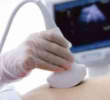 Cu ultrasunete a ovarelor: modul de preparare, norma și abaterea
