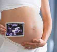 Uzi in timpul sarcinii - sexul copilului: ce o săptămână, iar primele semne de gen