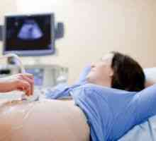 Uzi in timpul sarcinii: cât de multe săptămâni de a face 3 Uzi