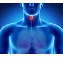 Nodurile glandei tiroide