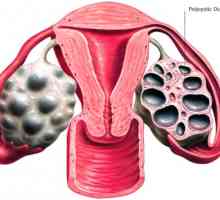 În mod normal, ovarele efectua două funcții - endocrine și generativă.