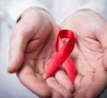 Infecției cu HIV: simptome la barbati, tratament