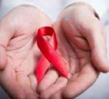 Infecției cu HIV: simptome la femei și prognosticul după tratament