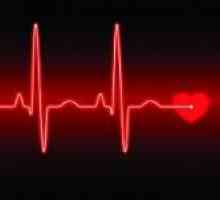 Simptome si diagnostic de aritmii cardiace