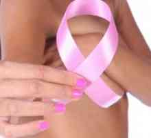 Tipuri de mastectomie, utilizate pentru cancerul de san