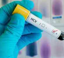 Sarcina virală în hepatita cu: tipuri de teste și interpretarea rezultatelor