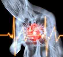 Moartea subită cardiacă de cauze de insuficiență coronariană acută și alte
