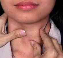 Atenție! Nod în glanda tiroidă