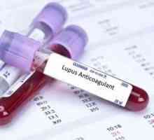 Lupus anticoagulant: unul este găsit, ceea ce este periculos, iar rata de respingere, tratament