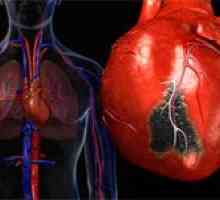 Posibile simptome de infarct miocardic