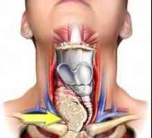Toate hipoplazie a glandei tiroide: ce este, care sunt simptomele și cum să fie tratate dacă…