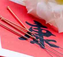 Totul despre acupunctura: utilizarea special în nevralgia