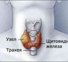 Întregul adevăr despre nodurile tiroidiene