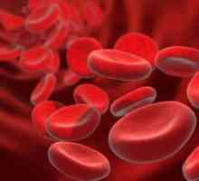 Analiza Scopul și transcriere a coagulării sângelui